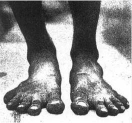 hunter gatherer feet